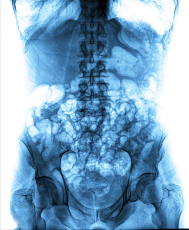 cape billing urology billing cape billing urology billing